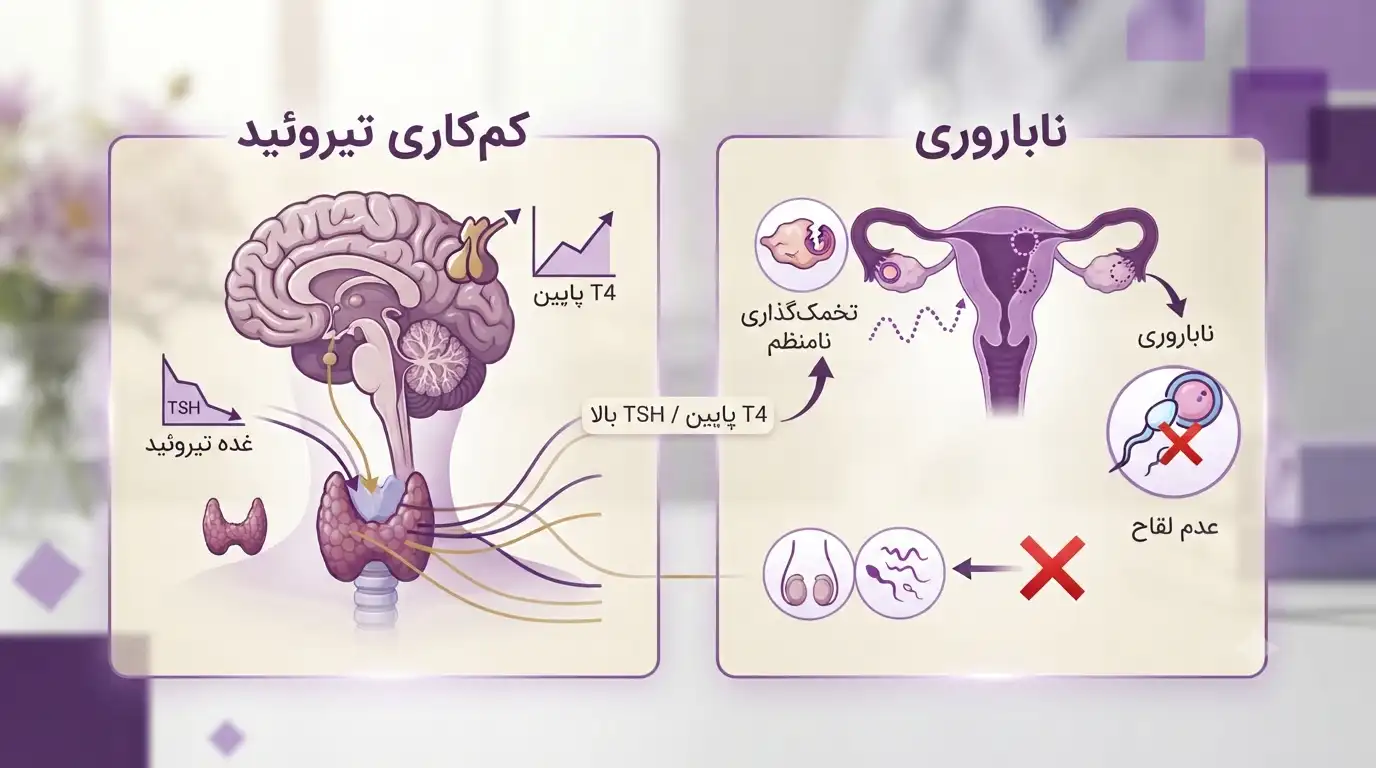 کم کاری تیروئید و ناباروری